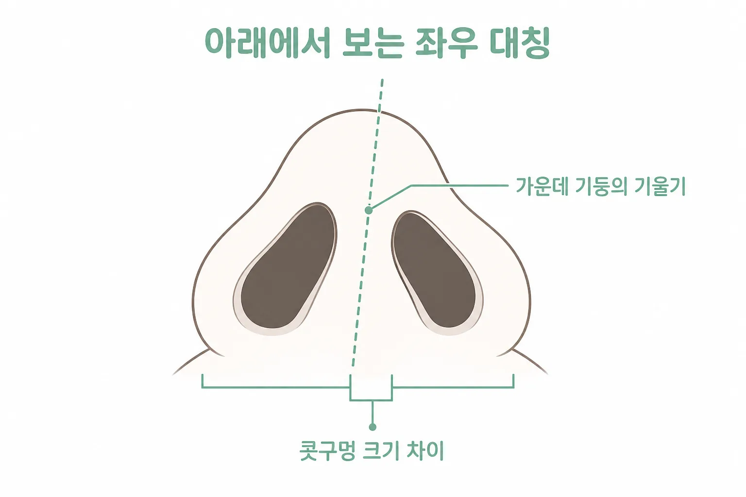 휜코는 아래에서 올려다볼 때 보입니다 — 가운데 기둥의 기울기와 콧구멍 크기 차이가 한 화면에 잡힙니다