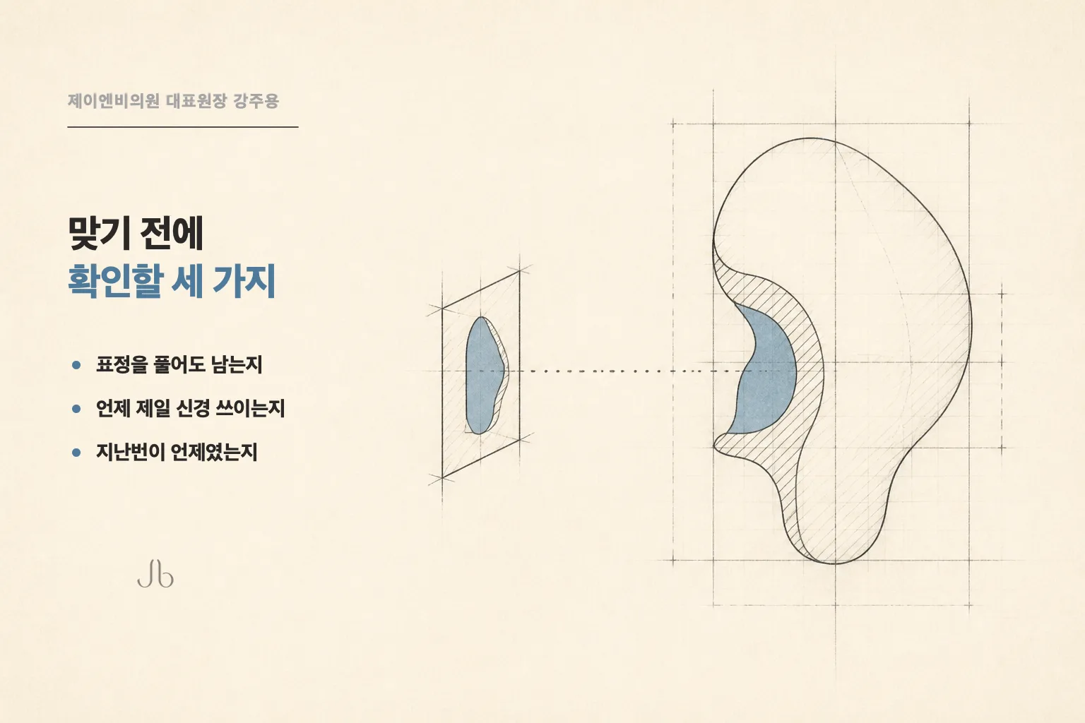 보톡스 상담 전 확인할 세 가지 — 표정을 풀었을 때 남는지, 신경 쓰이는 순간이 언제인지, 지난 시술이 언제였는지