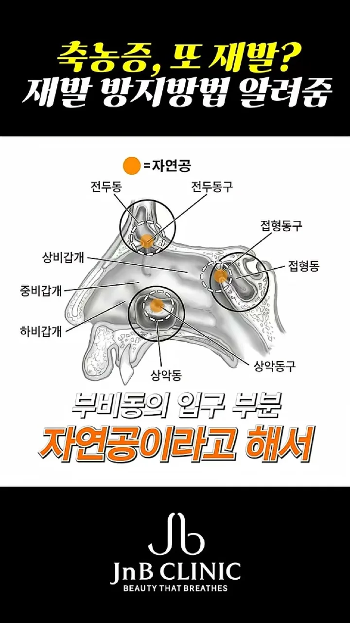 부비동의 위치와 입구를 표시한 선화 도식 — 전두동·상악동·접형동과 자연공 라벨, 유튜브 JNB Behind 영상 7초 장면