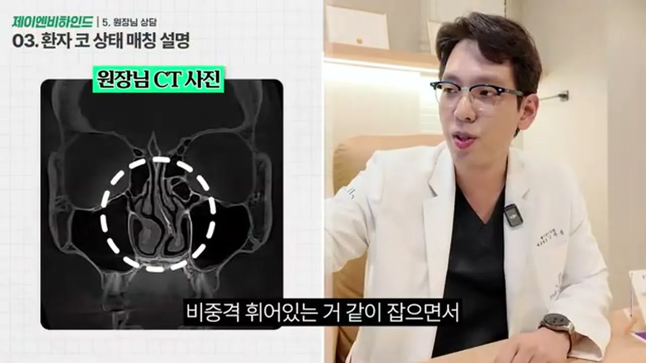 코성형 상담에서 CT 영상과 현재 비중격 상태를 함께 확인하는 장면