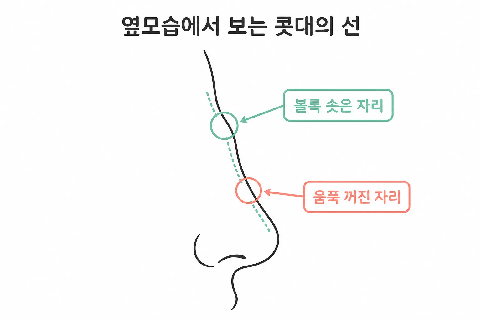 매부리코는 옆모습 콧대의 선에서 드러납니다 — 볼록 솟은 자리와 움푹 꺼진 자리, 목록 3번이 말한 융기와 꺼짐입니다