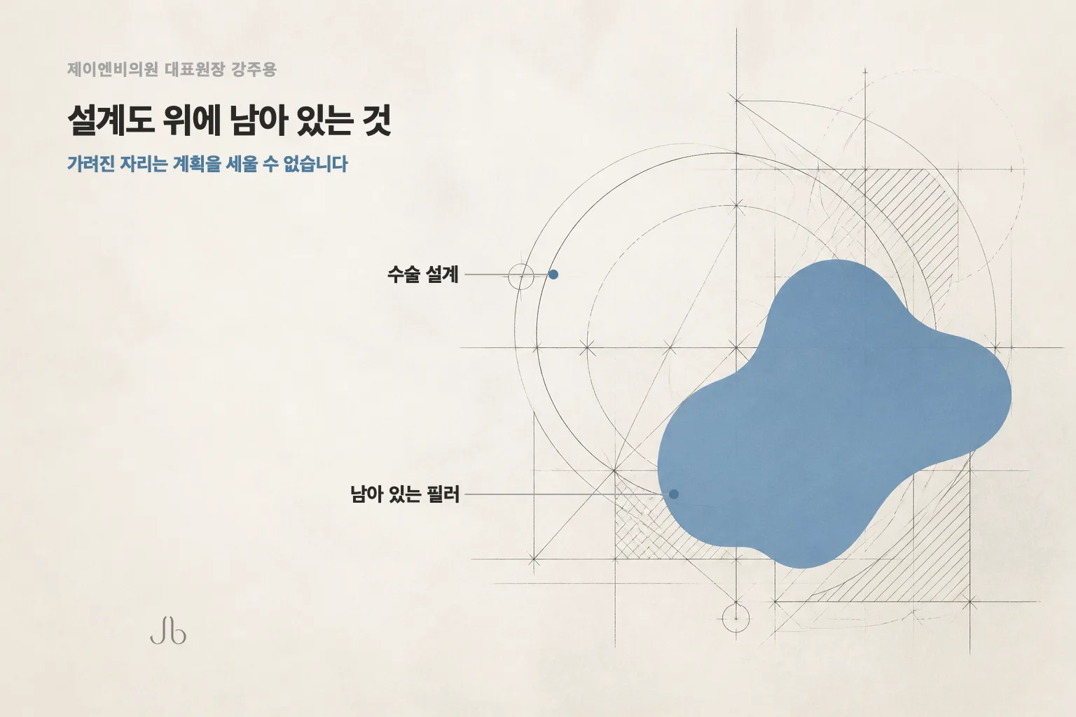 코 안에 남은 필러가 연골 이식과 보형물 디자인 자리에 겹쳐 수술 설계를 흔드는 상황을 보여 주는 도식
