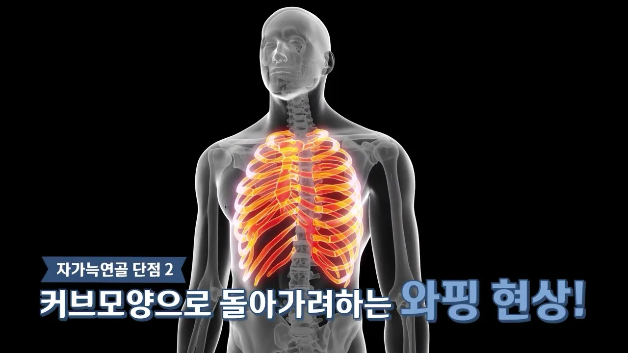 갈비뼈가 커브 형태임을 보여주는 3D 일러스트 — 커브모양으로 돌아가려는 와핑 현상 설명 장면