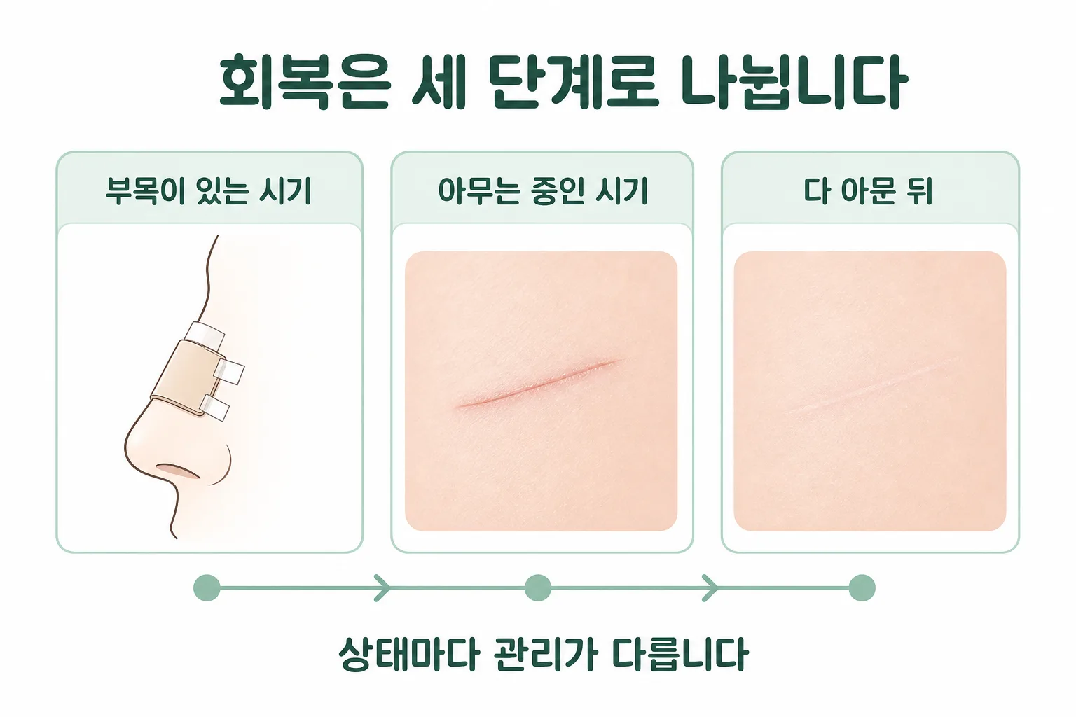 코수술 회복은 부목이 있는 시기·아무는 중인 시기·다 아문 뒤 세 단계 — 단계마다 가능한 관리가 다릅니다