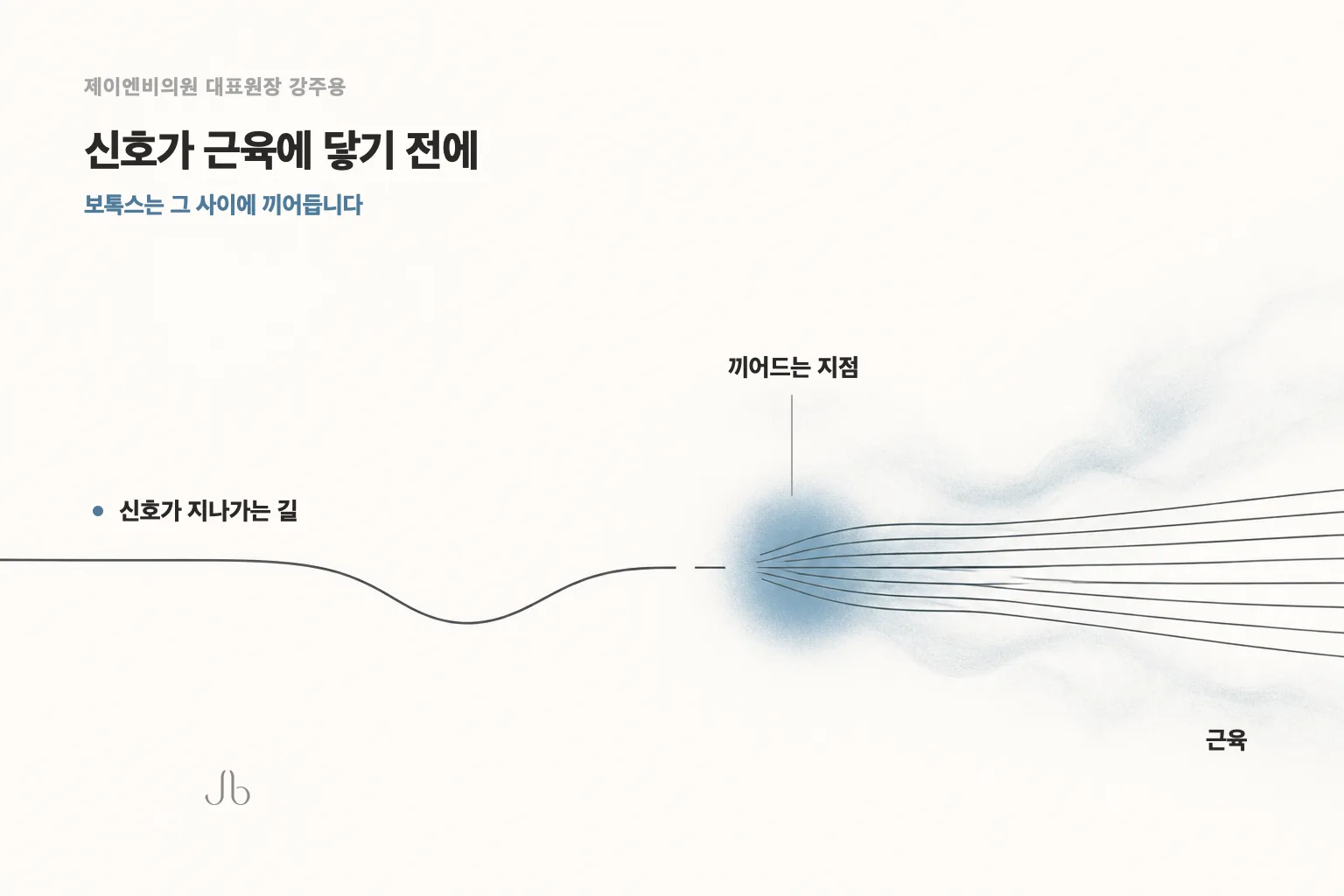 신경 신호가 근육에 전달돼 주름이 잡히는 순서와, 보톡스가 그 사이에 끼어드는 지점을 표시한 도식