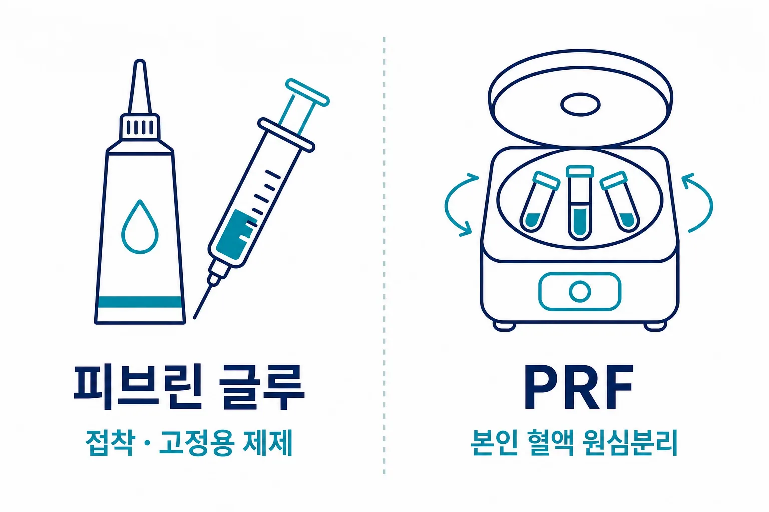 피브린 글루와 PRF의 출발점 차이 — 개념 이해를 돕기 위해 만든 참고 일러스트입니다