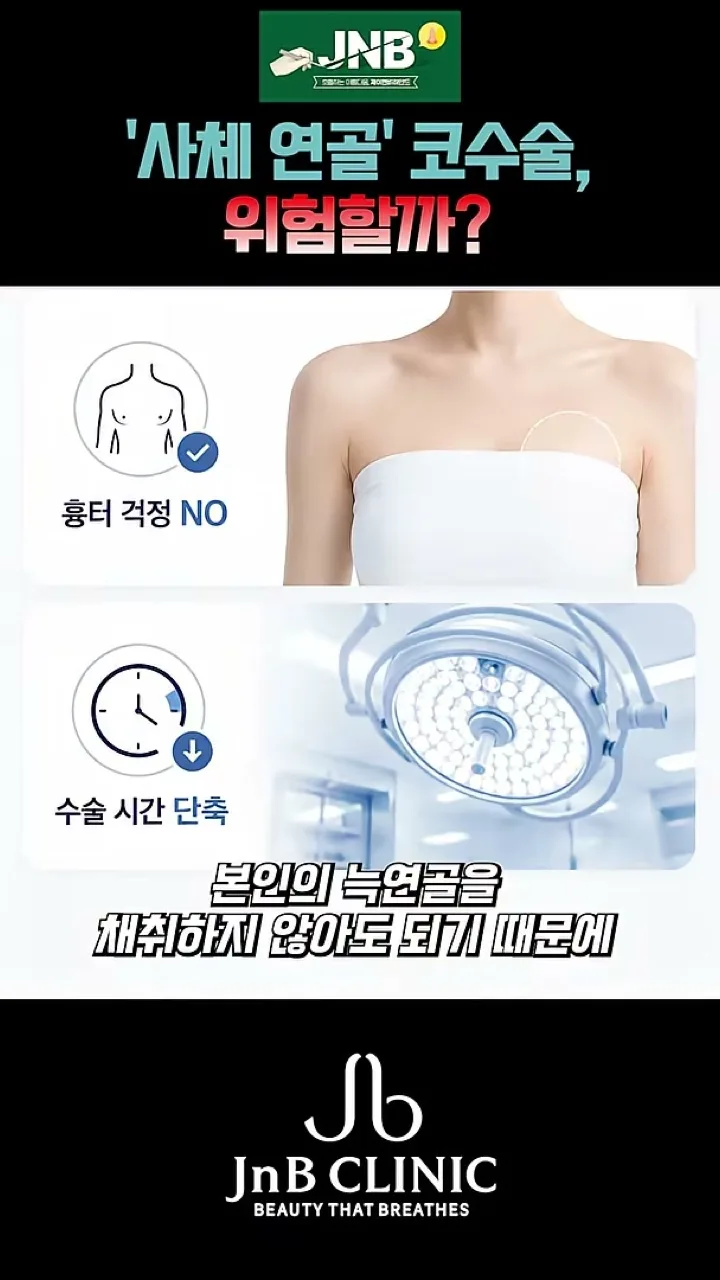 기증 늑연골의 장점을 정리한 도해 — 흉터 걱정 없음, 수술 시간 단축 (같은 영상 26초)