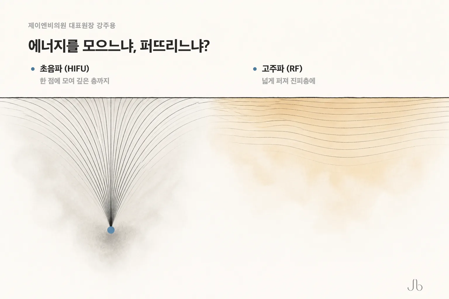 초음파는 한 점에 모여 깊은 층까지, 고주파는 넓게 퍼져 진피층에 닿는다는 차이를 나란히 놓은 비교