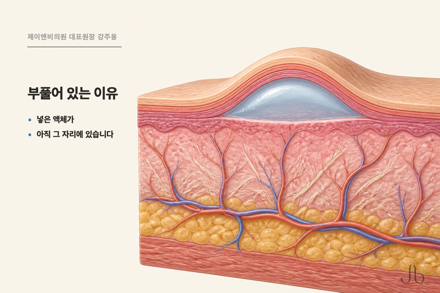 볼록하게 올라온 자국, 셀투오 후 무엇을 보고 판단하나요