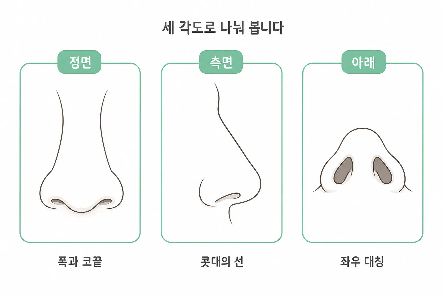 코성형이 다루는 고민 여섯 항목은 보는 각도로 묶입니다 — 정면은 폭과 코끝, 측면은 콧대의 선, 아래는 좌우 대칭