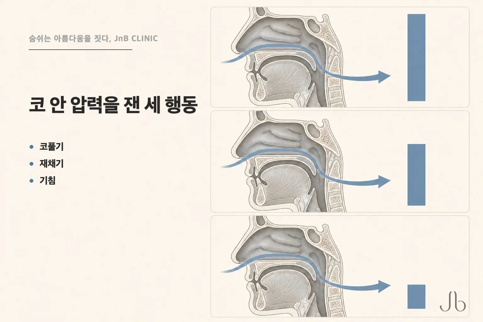 코 안 압력을 잰 세 가지 행동 — 코풀기·재채기·기침을 나란히 놓은 코풀기 압력 도식