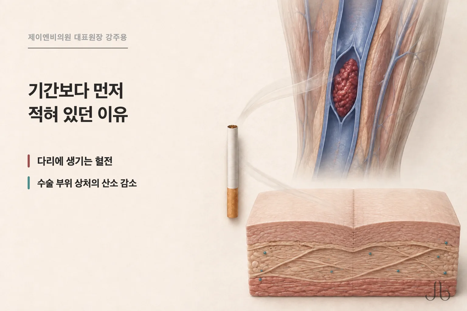 기간보다 먼저 적힌 이유 — 다리 정맥의 혈전과 수술 부위 상처의 산소 감소를 보여 주는 의학 단면
