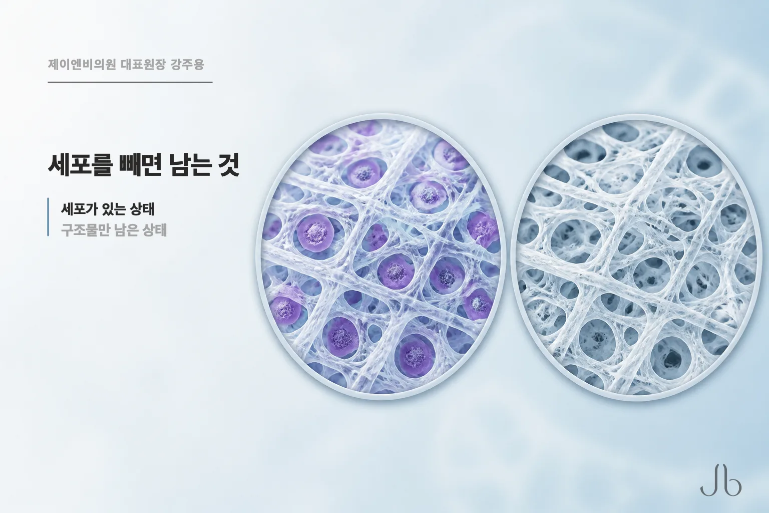 탈세포화 공정 후 남는 것 — 세포는 제거되고 세포외기질 구조물만 남는다