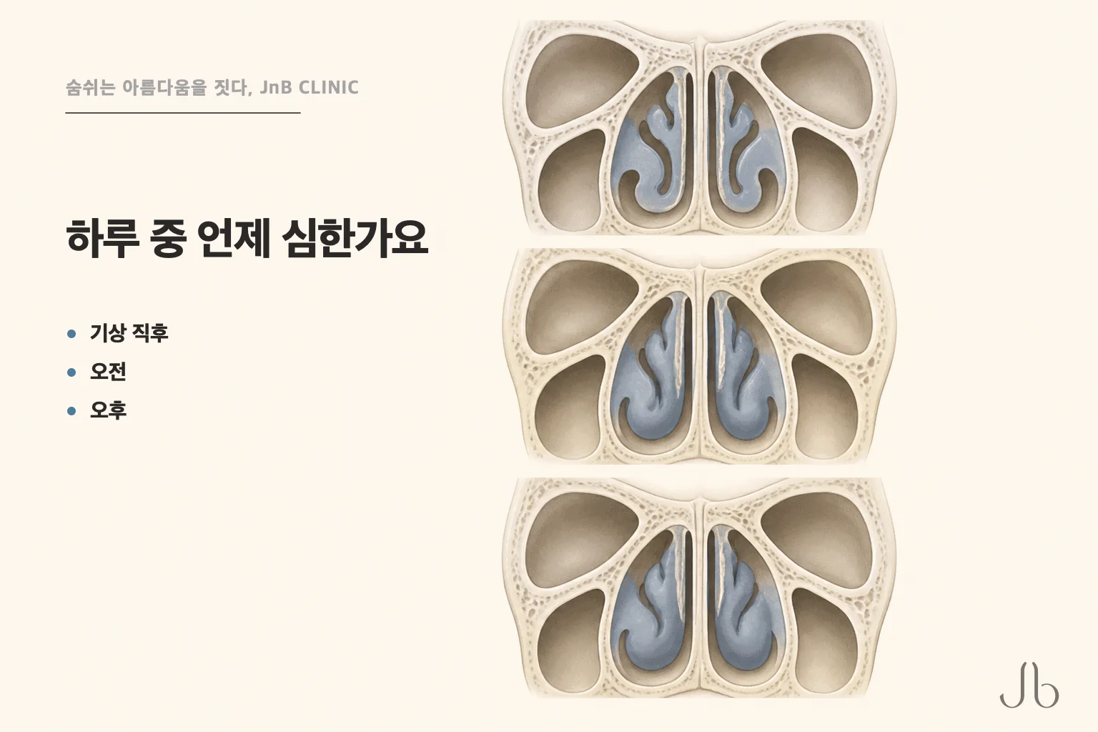 아침 코막힘이 하루 중 언제 심한지를 기상 직후·오전·오후 세 자리로 나눠 묻는 도식