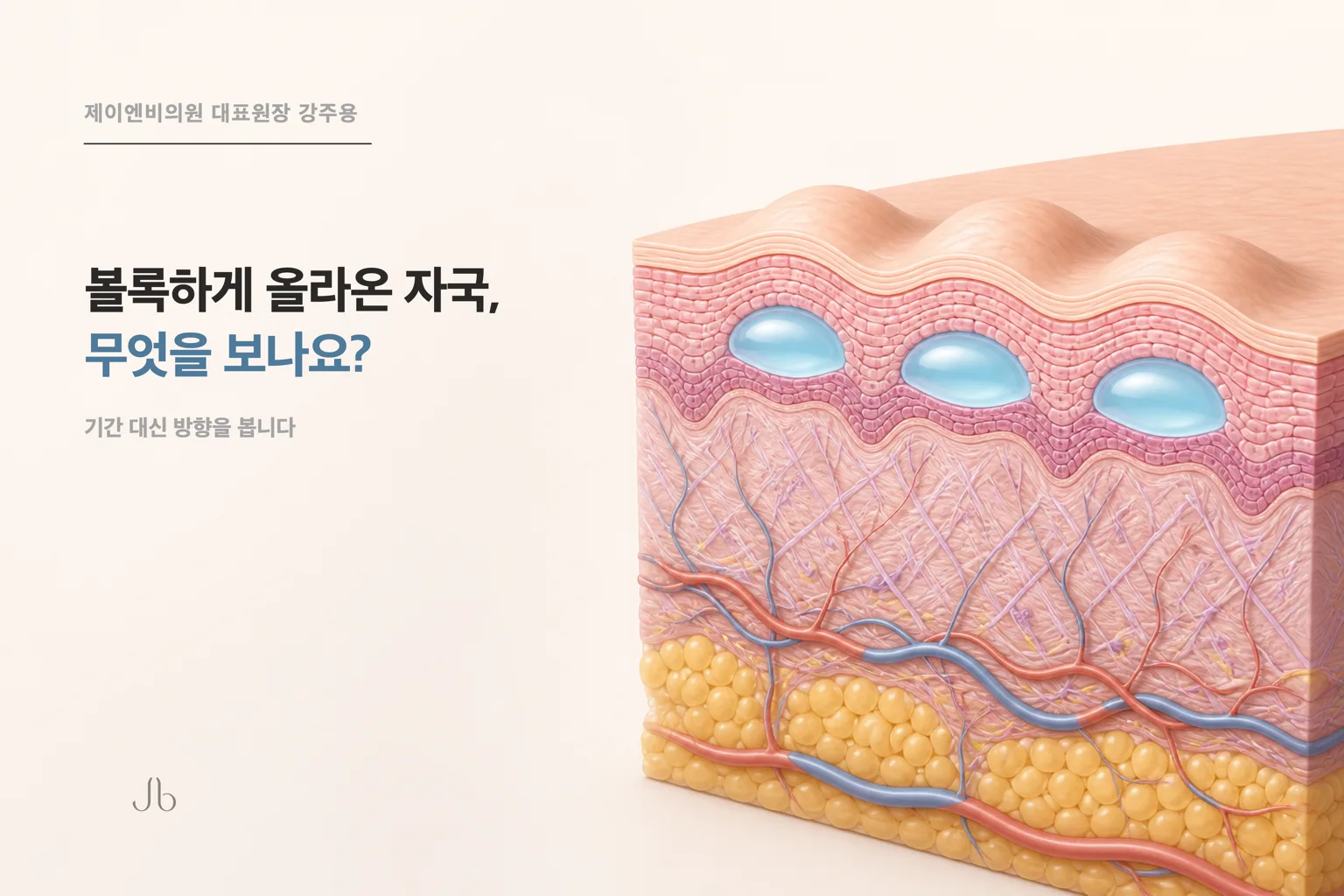 셀투오 후 볼록하게 올라온 자국을 무엇으로 판단하는지 정리한 피부 밸런스 표지