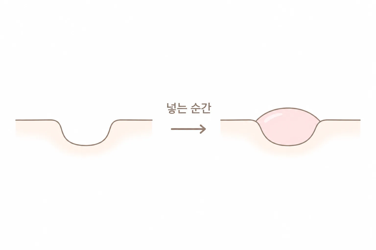 채워서 결과가 나오는 쪽은 넣는 순간 자리가 생깁니다 — 파인 표면이 도로 올라오는 두 그림