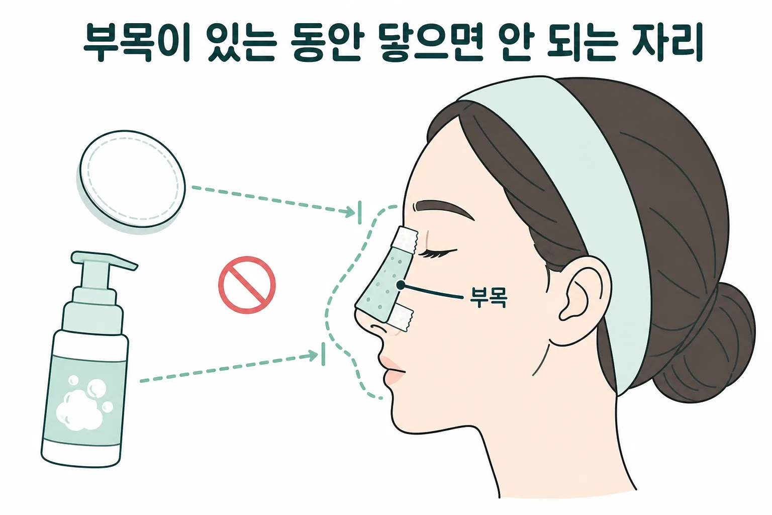 코수술 후 부목이 붙어 있는 동안 닿으면 안 되는 자리 — 클렌징 폼도 화장솜도 부목과 그 둘레를 피해 갑니다