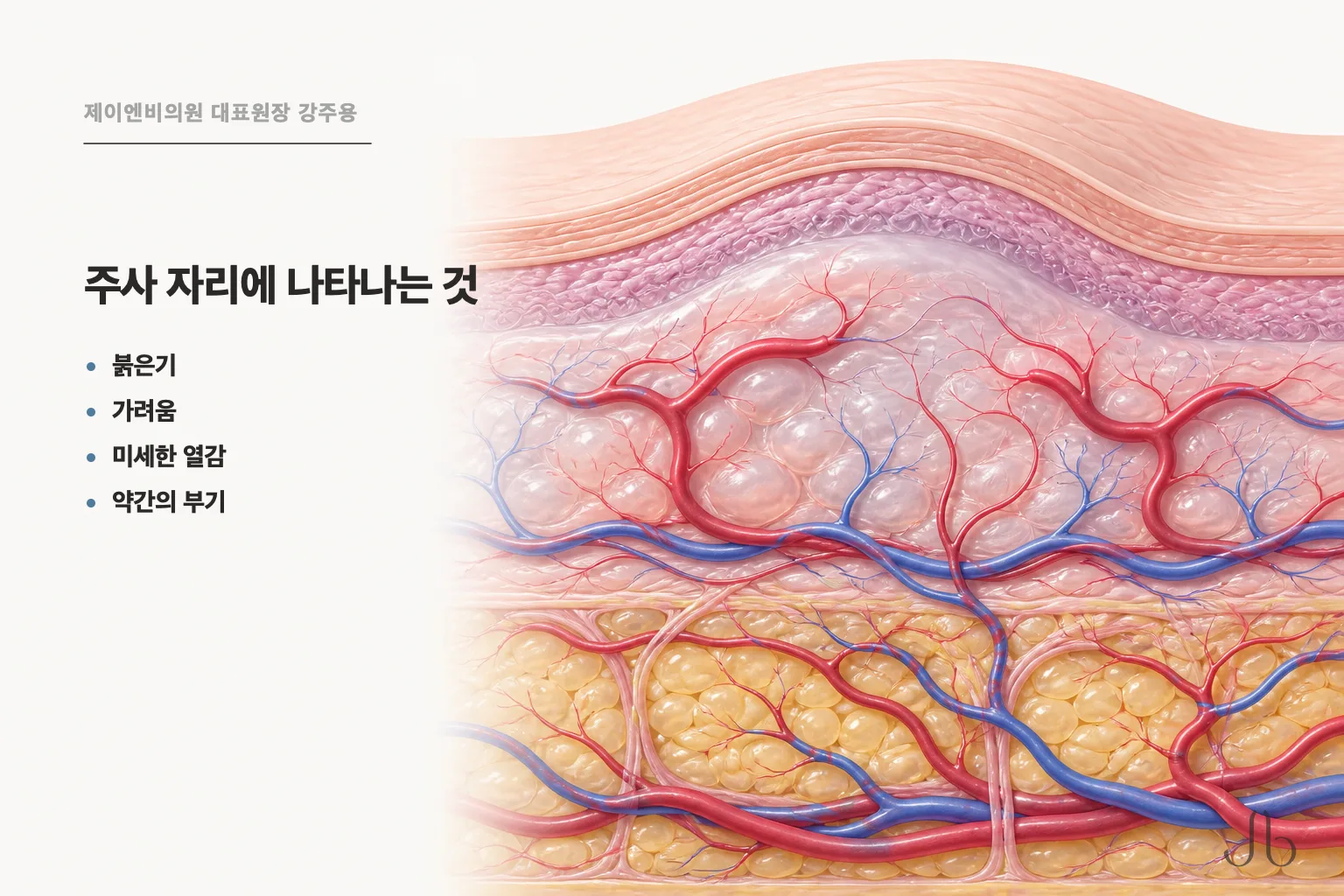 주사 시술 직후 흔히 나타나는 반응들 — 붉은기, 가려움, 미세한 열감, 부기