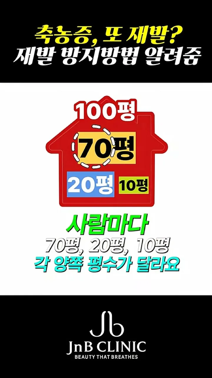 사람마다 다른 부비동 크기를 100평·70평·20평·10평 집으로 표현한 그래픽 — 같은 영상 40초