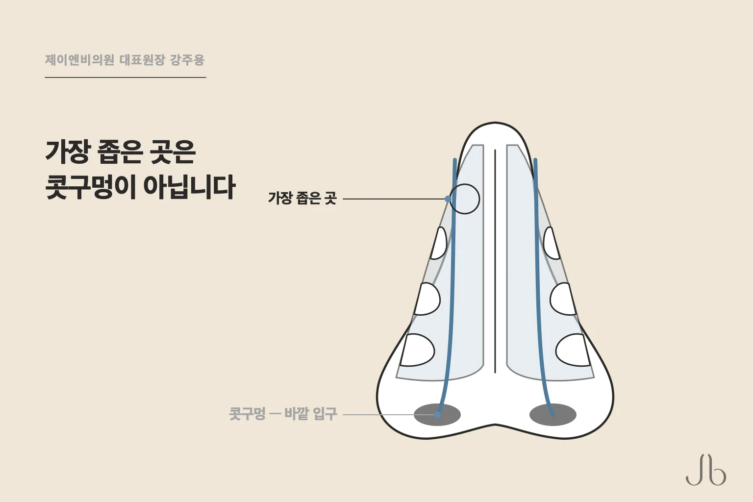 내비밸브는 코 기도에서 단면이 가장 좁은 자리이고, 콧구멍은 그 바깥 입구입니다