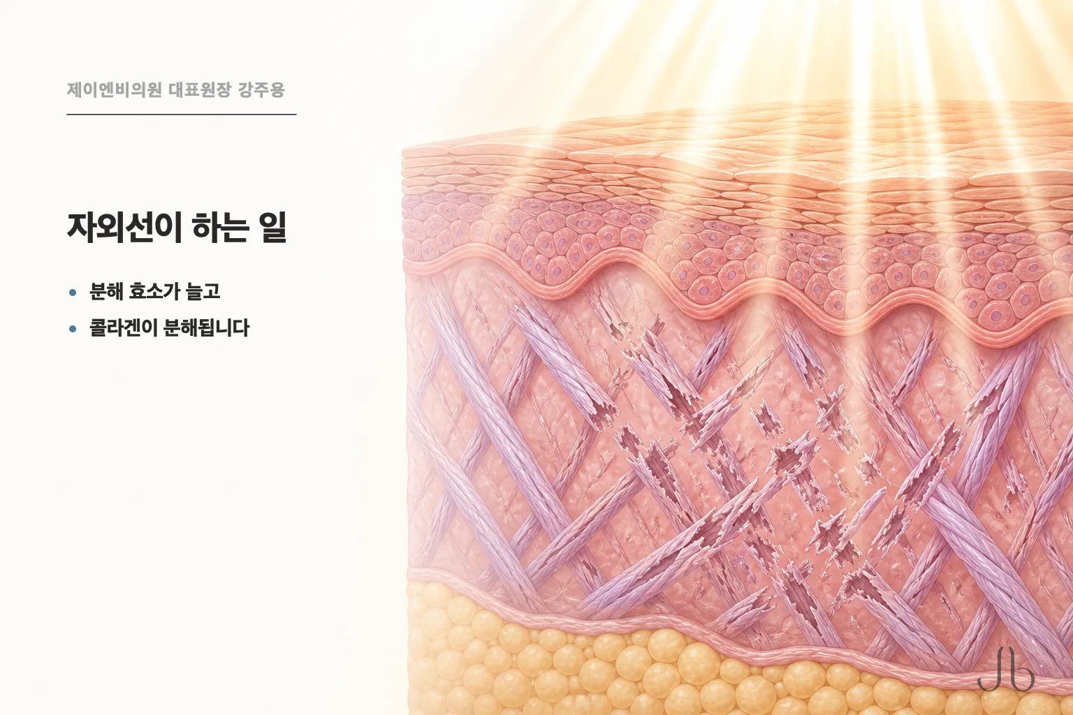 리투오를 받은 뒤, 콜라겐은 생활에서 무엇에 깎이나요