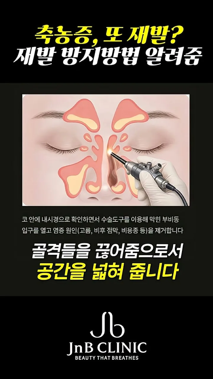 내시경으로 확인하며 수술 도구로 막힌 부비동 입구를 여는 단면 일러스트 — "골격들을 끊어줌으로서 공간을 넓혀 줍니다", 같은 영상 25초