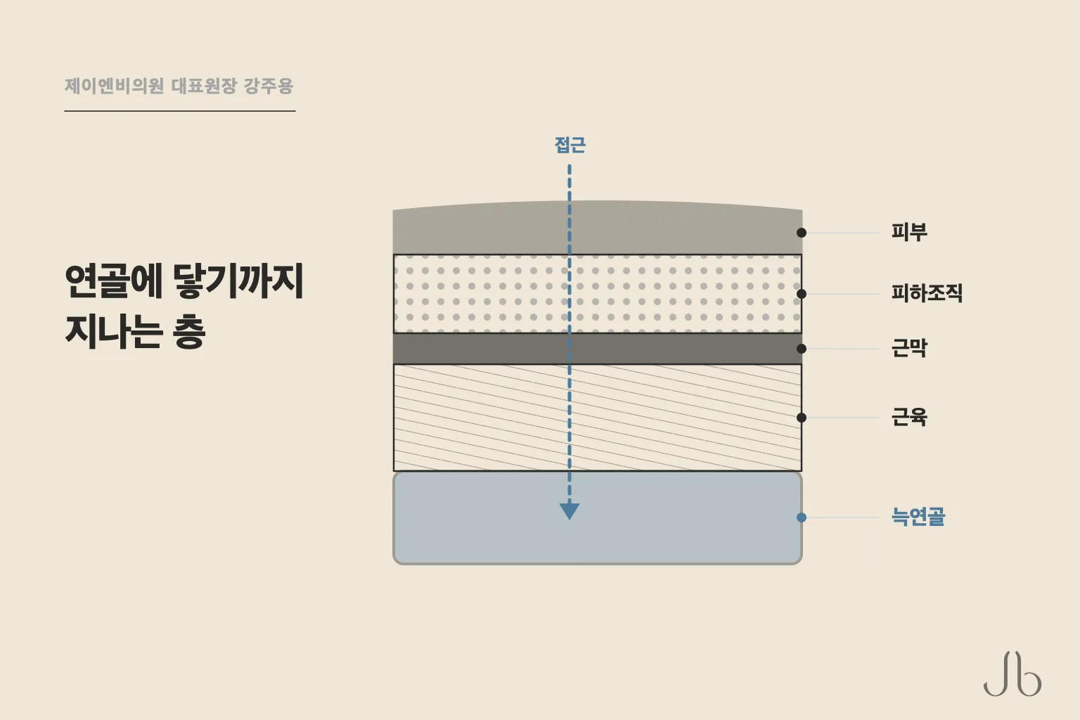 늑연골에 접근할 때는 피부와 피하조직, 근막, 근육을 지나 연골에 닿습니다