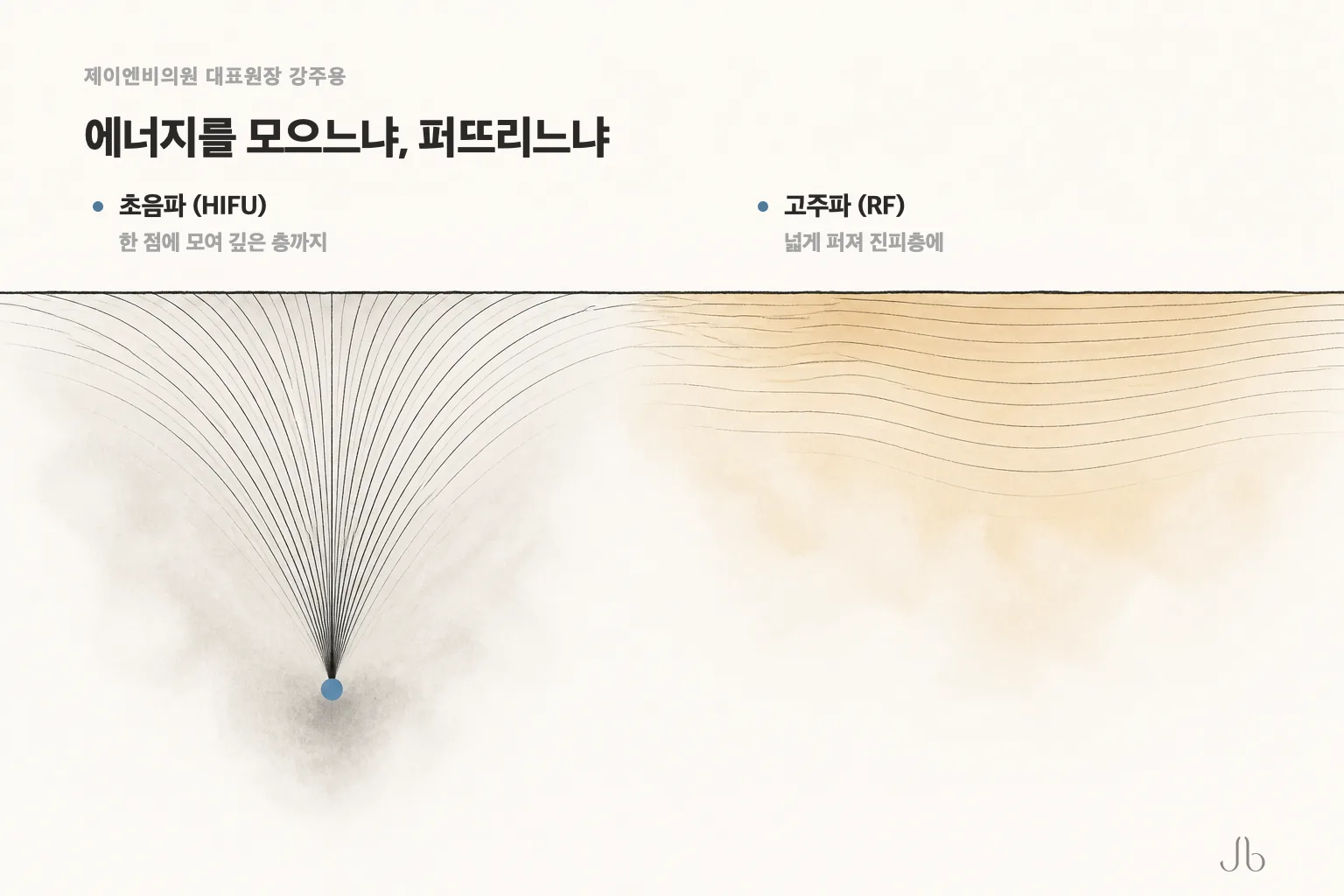 초음파는 한 점에 모여 깊은 층까지, 고주파는 넓게 퍼져 진피층에 닿는다는 차이를 나란히 놓은 비교